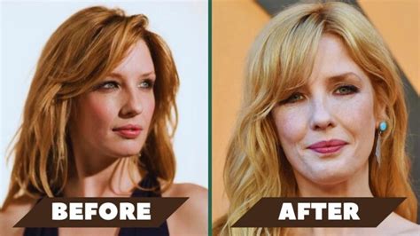 Kelly Reilly’s Lip Surgery: Separating Fact From Fiction With Photos!